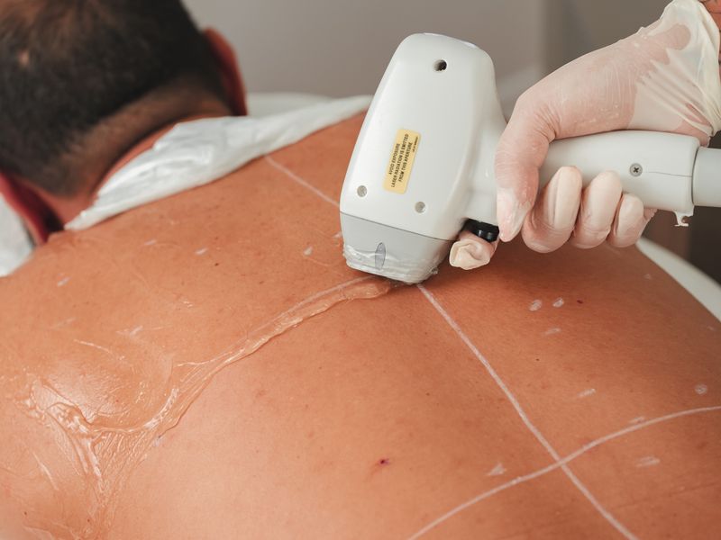An aesthetic treatment in a bright clinic setting